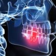 Sprawdzone domowe sposoby na ból zęba