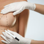 Plastyka piersi, czyli ich powiększenie, pomniejszenie czy lifting – Fakty i mity nt. operacji plastycznych biustu