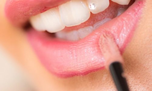 Zapytaj stomatologa: Kamień nazębny – nieestetyczny, niehigieniczny – jak się go pozbyć?